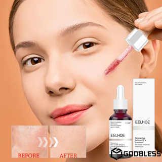 (Hàng Mới Về) Serum Trị Mụn Tẩy Tế Bào Chết Kiểm Soát Dầu Dưỡng Ẩm Làm Săn Chắc Da