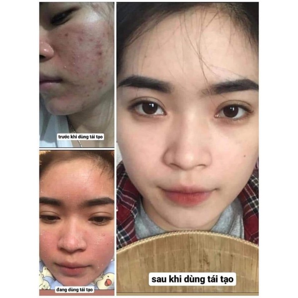 Kem tái tạo da sâm đen