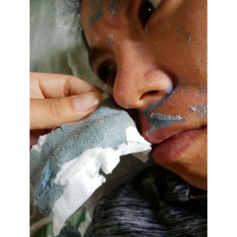 [ Hàng Hót ] Gell Lột Mụn DR.ACNE cty Hải Âu | Thế Giới Skin Care