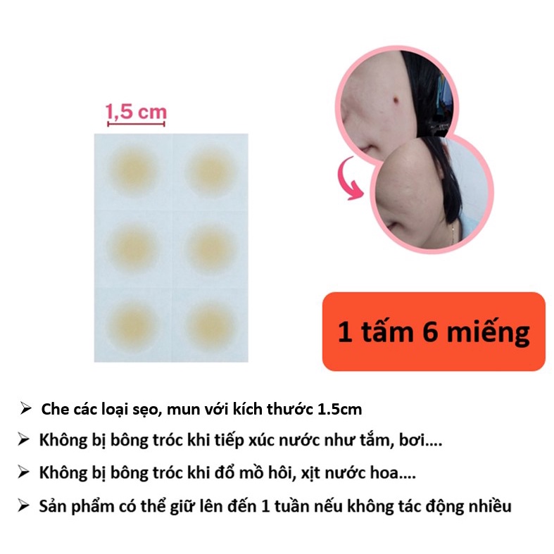 Miếng dán che sẹo sẹo lồi mụn SAKURA Nhật Bản Size 1.5cm