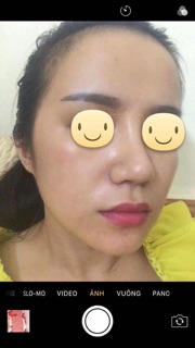 Bột xông thiên nhiên thải độc da