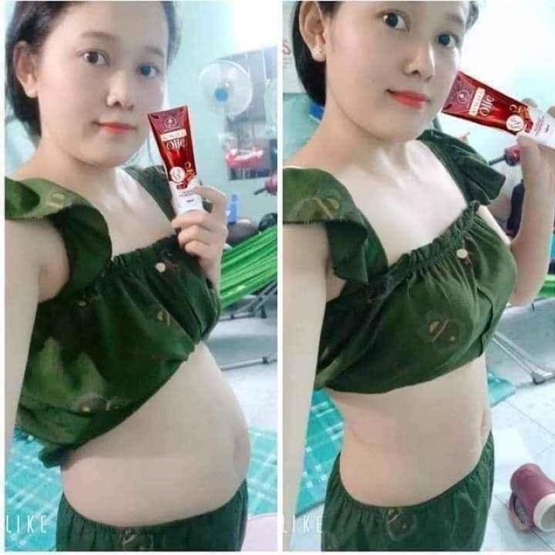 Kem tan mỡ olic chính hãng