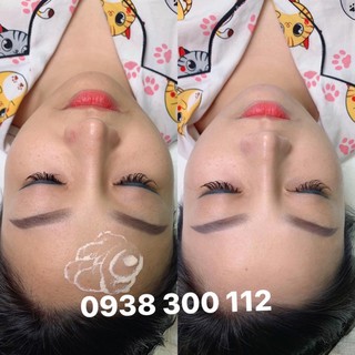 (MẪU MỚI) PHẤN CẤY MESO WHITE HÀN QUỐC (HÀNG CHUẨN)