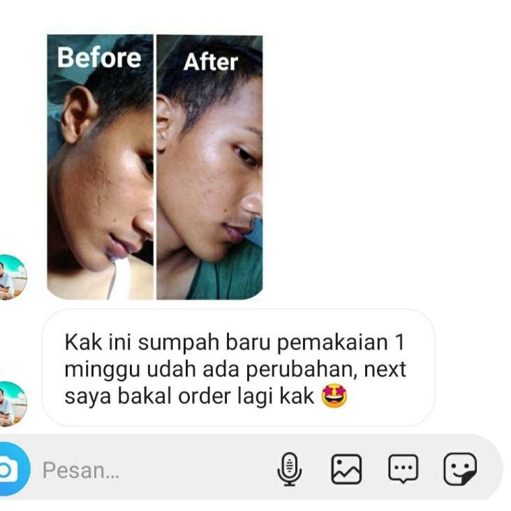 Tinh Dầu Trị Mụn Và Sẹo 5.5 Falabelle Gardenu 30Ml | BigBuy360 - bigbuy360.vn