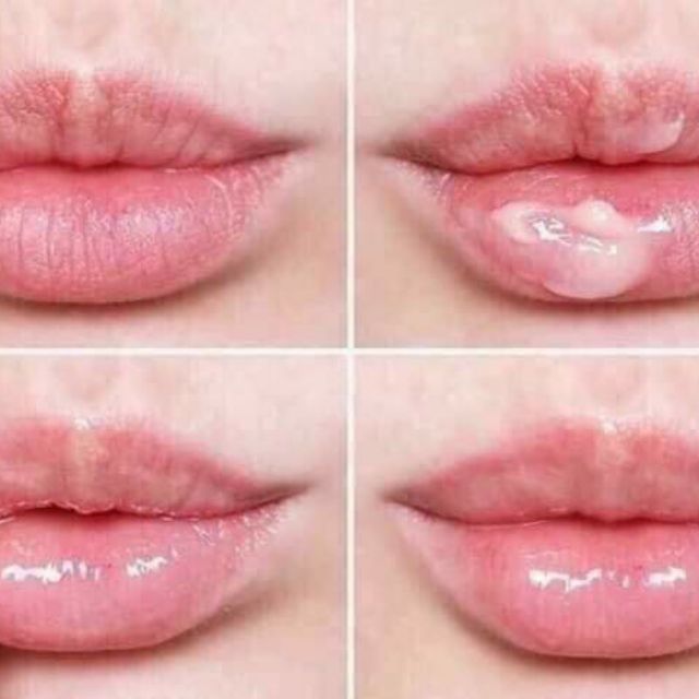 Ủ môi thần thánh