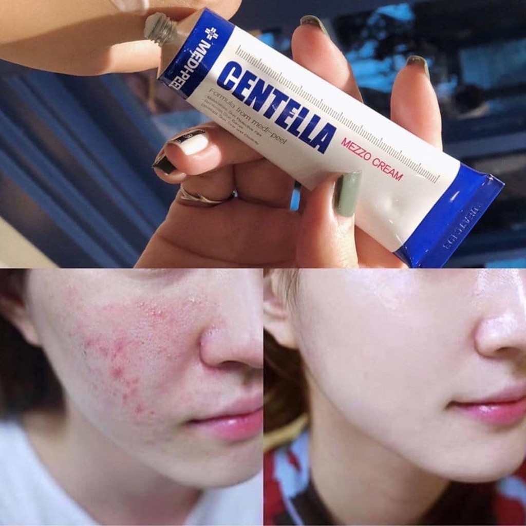 Kem Ngừa Mụn Phục Hồi Da Tinh Chất Rau Má Medi-Peel Centella Mezzo Cream - Medi Peel