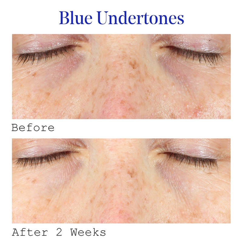 🍊 Serum dưỡng mắt Murad VITAC EYE Dark Circle C0rrect0r