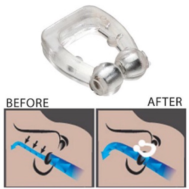 Dụng cụ giảm tiếng ngáy khi ngủ Noseclip