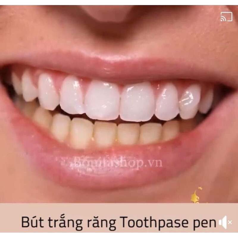 Bút làm trắng răng qua đêm Colgate 2,5ml