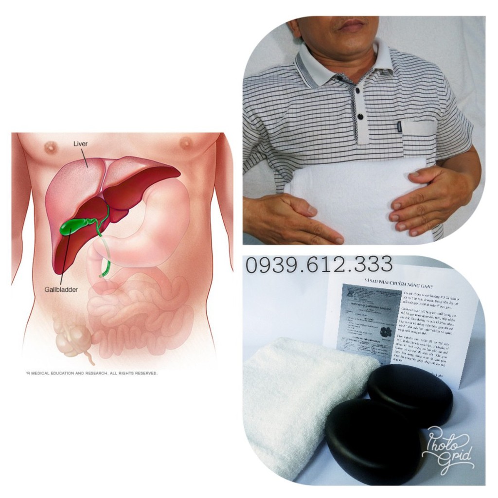 Combo Cặp Đá Chườm Gan TẶNG Khăn Chườm + Bao Tay & Kèm Chi Tiết Kỹ Thuật Chườm Đá
