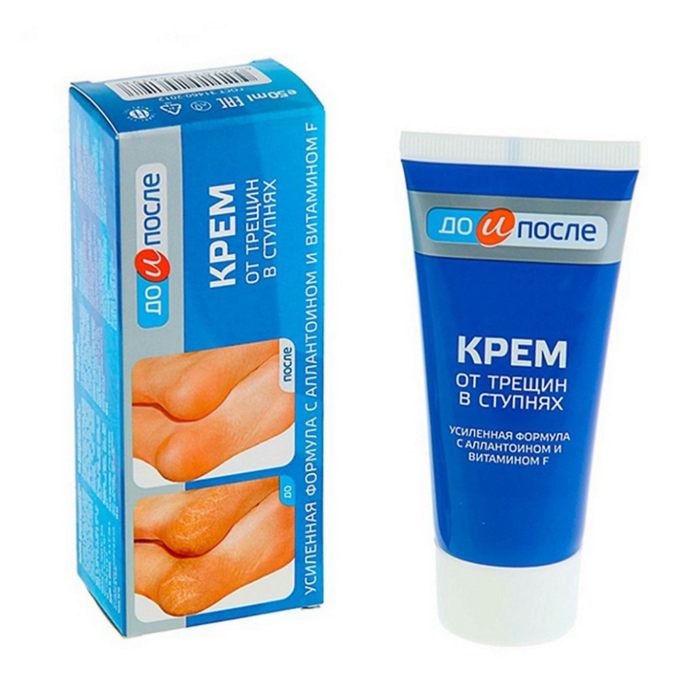 Kem Nứt Gót Chân ❤️𝑭𝒓𝒆𝒆𝒔𝒉𝒊𝒑❤️ Kem Ngăn Ngừa Và Hồi Phục Nứt Nẻ Gót Chân Kpem Nga 50ml