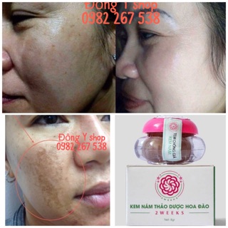 Kem Nám Hoa Đào 2 weeks Vượng Xuân Đường