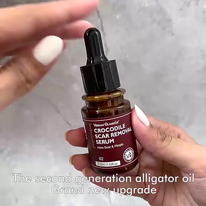 Vibrant Glamour Scar Repair Serum 30ml Điều trị mụn cá sấu thế hệ 2 Loại bỏ vết rạn da Loại bỏ sẹo mụn Dưỡng ẩm Chăm sóc da Beauty metro | BigBuy360 - bigbuy360.vn