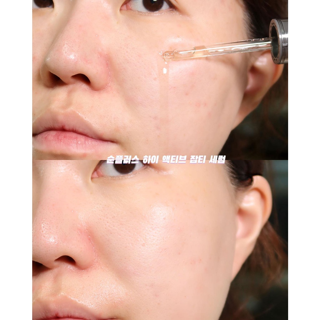 Tinh Chất Làm Sáng Mờ Thâm Phục Hồi Soonplus Soon Soon+ Blemish Care Serum 30ml