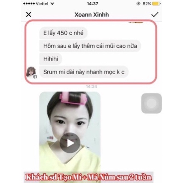 Tinh chất Miracle Pháp tạo mắt 2 mí, mở tròng mắt siêu hiệu quả