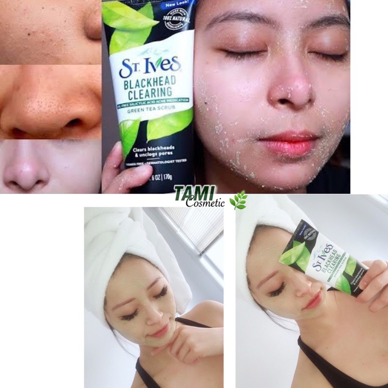 ST.IVES TẨY DA CHẾT & SỮA RỬA MẶT | BigBuy360 - bigbuy360.vn