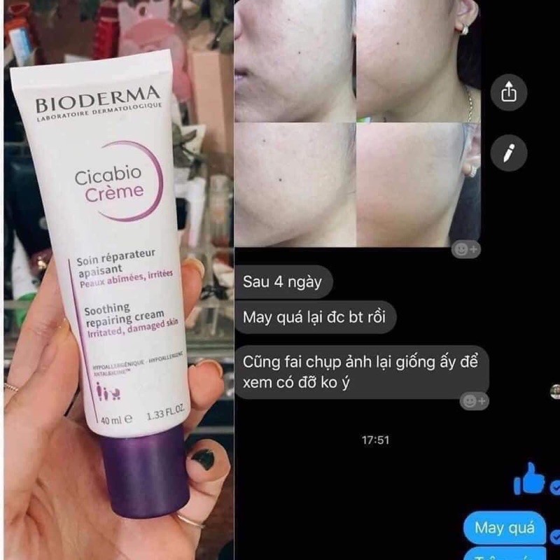 kem dưỡng bio cicabio cream