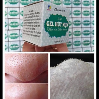 Gel lột mụn bạc hà