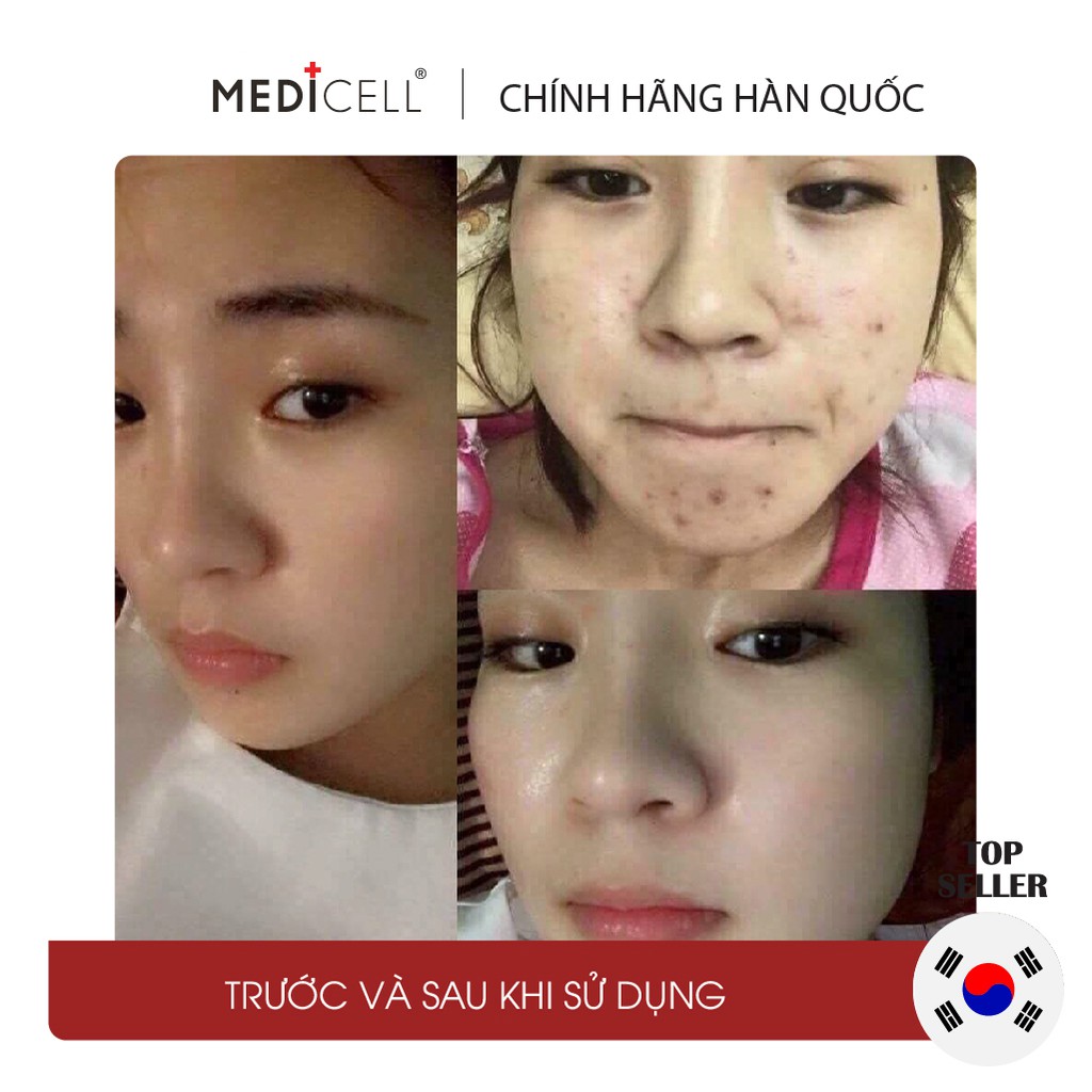 Tế bào gốc cá hồi DNA Medicell dưỡng trắng, kiềm dầu, căng bóng da, mờ thâm sạm, se khít lỗ chân lông lọ 5ml