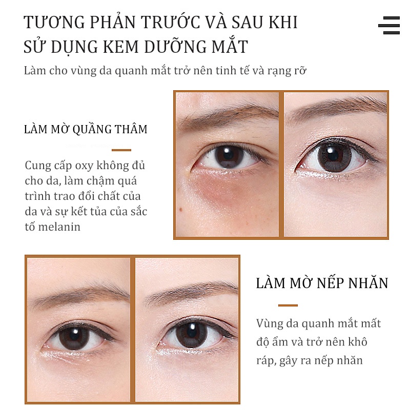 30G Kem Dưỡng Ẩm Chống Nhăn Vùng Mắt Làm căng da mắt, cải thiện nếp nhăn quanh mắt giảm quầng thâm và xóa tan mệt mỏi