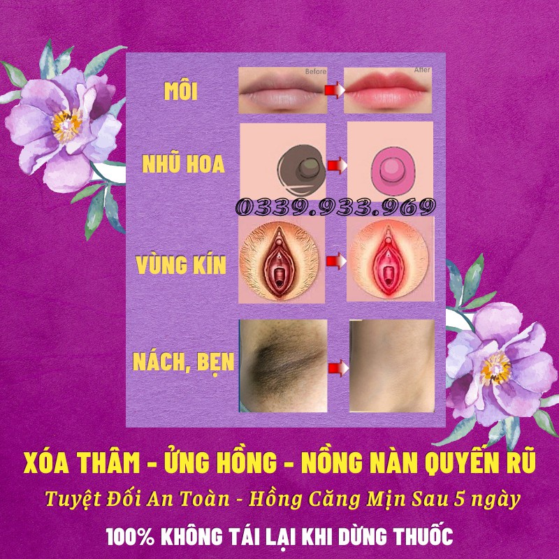 Ready Stock COD Chống Thâm Môi - Làm Hồng Môi - Làm Hồng Nhũ Hoa - Làm Hồng Vùng Kín Sexy Pink Aichun Beauty 30g Ready Stock