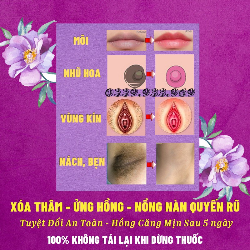Ready Stock COD Chống Thâm Môi - Làm Hồng Môi - Làm Hồng Nhũ Hoa - Làm Hồng Vùng Kín Sexy Pink Aichun Beauty 30g Ready Stock | BigBuy360 - bigbuy360.vn