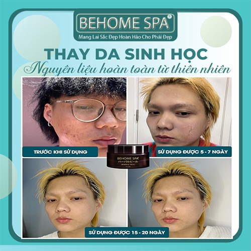 Thay Da Sinh Học 👉Freeship 👉Thay da sinh học Behome Spa - kem tái tạo da nám tàn nhang không đều màu dưỡng trắng da