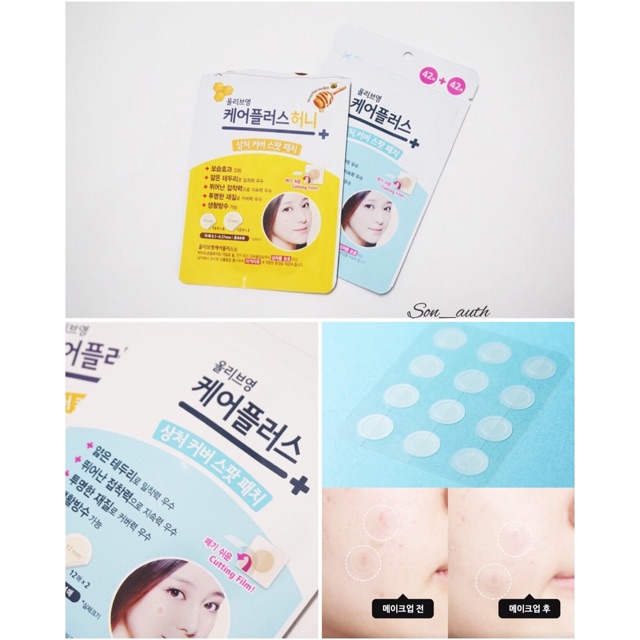 Miếng dán mụn Olive Young CarePlus | BigBuy360 - bigbuy360.vn