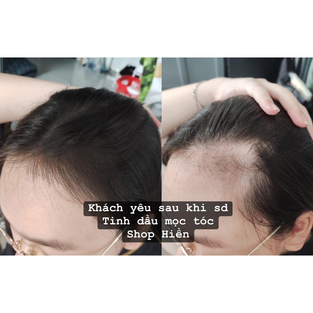 SHOP HIỀN _ TINH DẦU BƯỞI MỌC TÓC