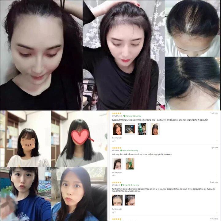 Tinh dầu mọc tóc nhanh,dau dưỡng tóc,serum mọc tóc,ngăn ngừa rụng tóc hair oil grow 30ml kích mọc tóc | BigBuy360 - bigbuy360.vn