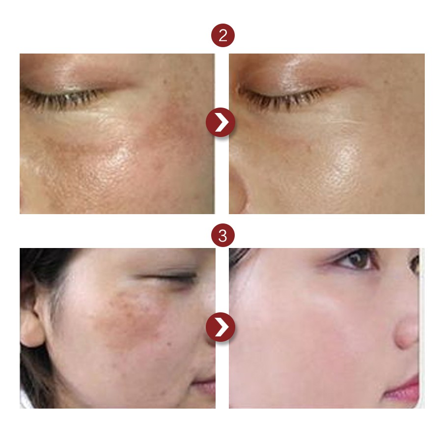 Tinh Chất peptide 100% Nguyên Chất 100ml Chống Nếp Nhăn Dưỡng Ẩm Làm Săn Chắc Da Mặt