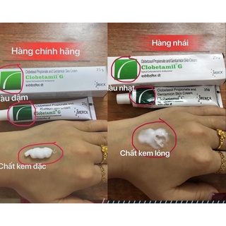 Típ nám tàn nhang