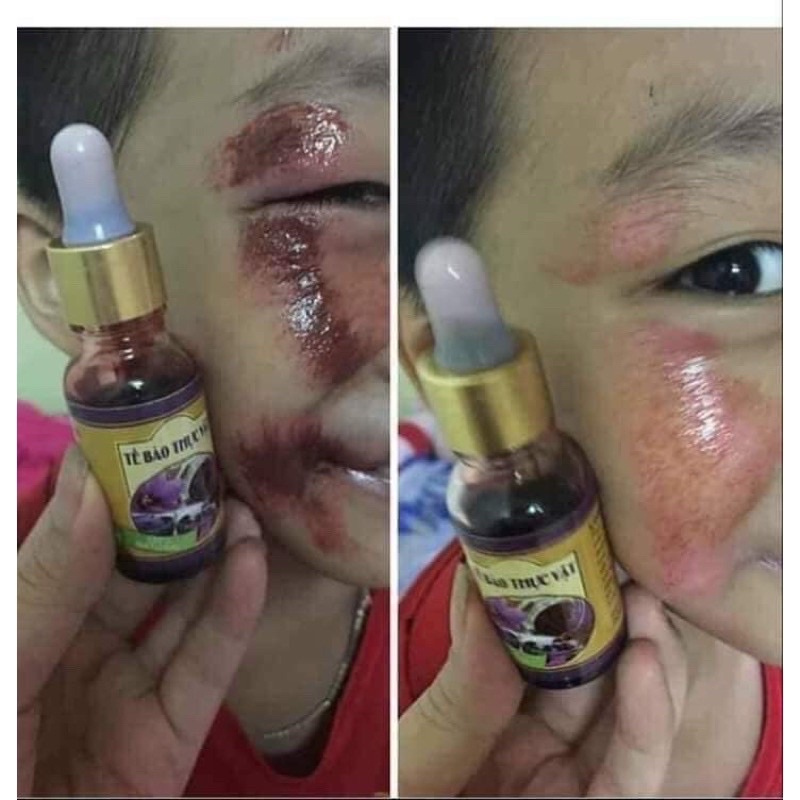 Cấy trắng bạch mộc trương mai bộ 4 món