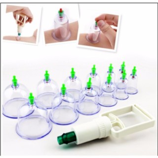 Bộ giác hơi 12 món không dùng lửa