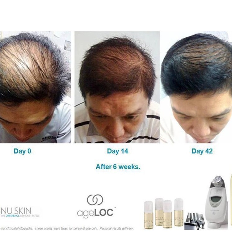 Dầu Gội Xả Tinh Chất ageLOC Nutriol Nuskin & Thiên Thảo kích thích mọc tóc trị hói | BigBuy360 - bigbuy360.vn