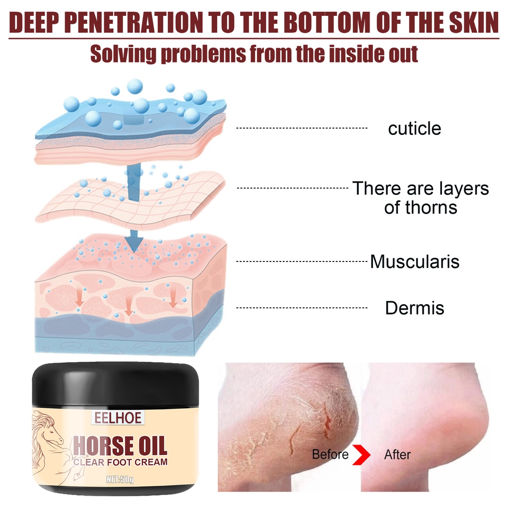 Kem Dưỡng Ẩm Chăm Sóc Da Chân Bị Nứt Nẻ Và Vết Chai Da Chân