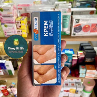 Kem Nứt Gót Chân Nga Kpem Apteka Nga