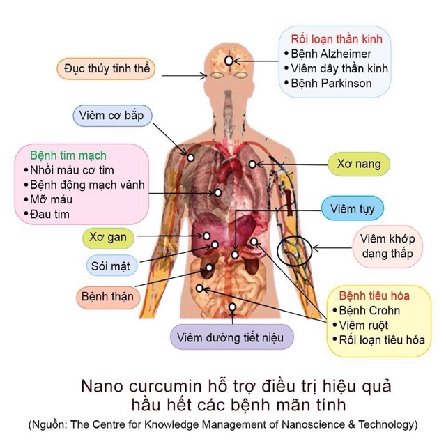 Nghệ nano- NANO CURCUMIN FORMULA 1-Viện Hàn lâm Việt Nam - nano nghệ dạng gel giúp hấp thu nhanh nhất - hiệu quả nhất | BigBuy360 - bigbuy360.vn