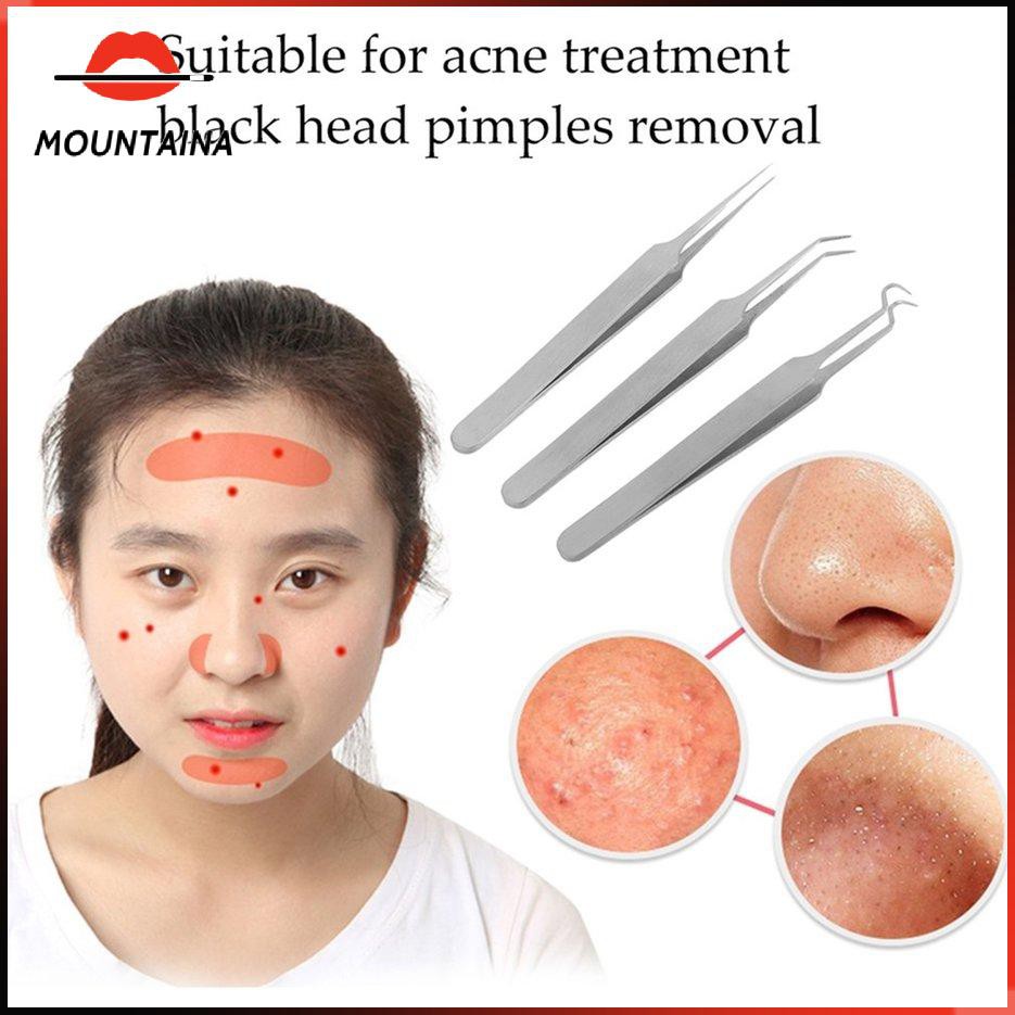 Nhíp nhổ lông, tóc bạc loại chắc | BigBuy360 - bigbuy360.vn