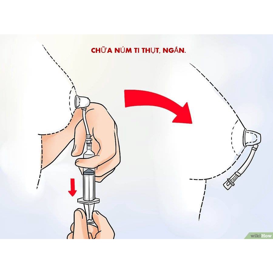 2 ĐẦU HÚT Dụng cụ kéo dài đầu ti, núm vú, chữa đầu ti thụt, ngắn, phẳng không có đầu ti