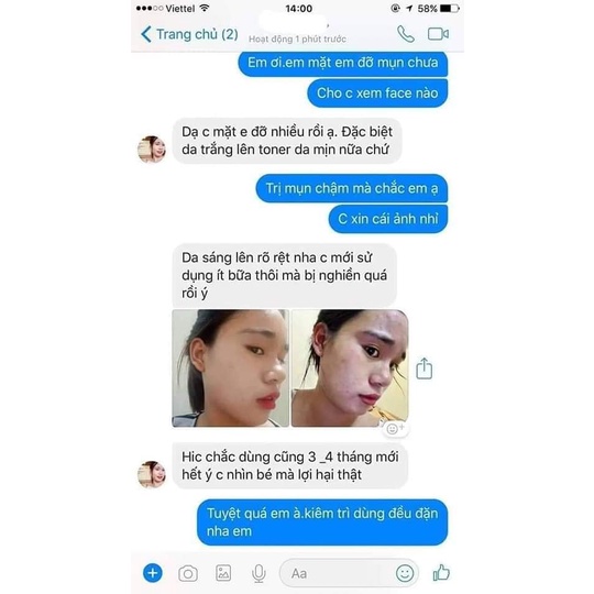 Dưỡng da giảm mụn, xoá nám tàn nhang 1T