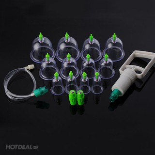Bộ giác hơi 12 ly không dùng lửa