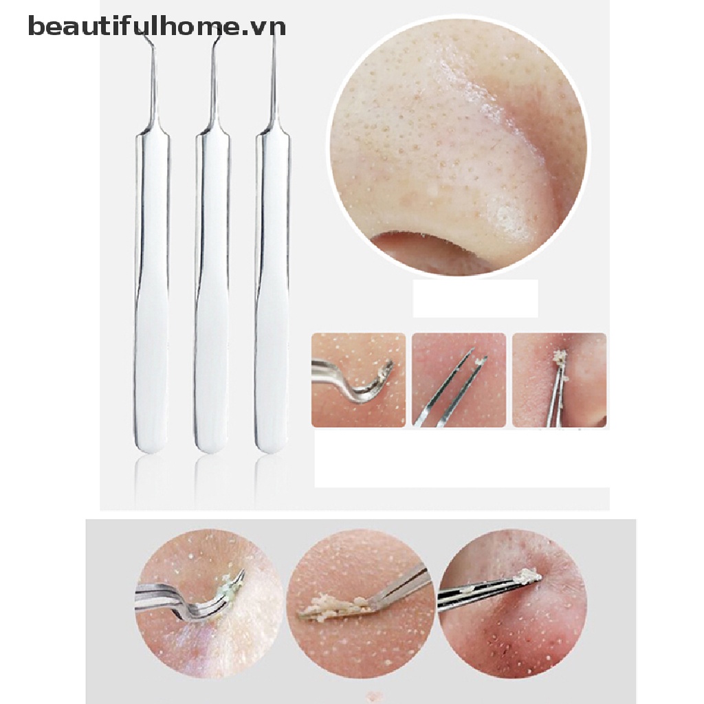 (Hàng Mới Về) Dụng Cụ Nặn Mụn Đầu Đen An Toàn Tiện Lợi