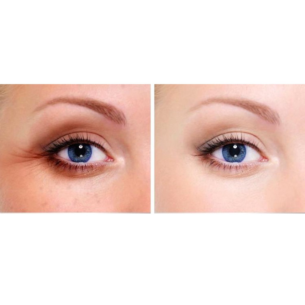 Tinh Chất Dưỡng Mắt, Giảm Quầng Thâm, Nếp Nhăn Balance Active Formula Dragon's Blood Eye Lift Balm 15ml | BigBuy360 - bigbuy360.vn