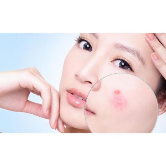 ✅ (HÀNG CHUẨN AUTHENTIC) Kem Gỉam Mụn Chuyên Biệt La Roche Posay Effaclar A.I | BigBuy360 - bigbuy360.vn