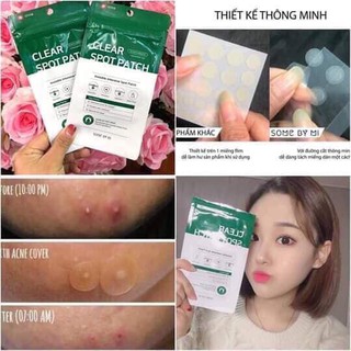 Miếng dán mụn AHA Some by mi