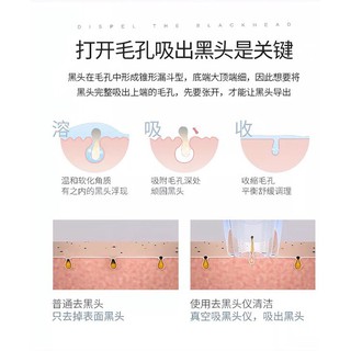 MAY HÚT MỤN CÁM MINI