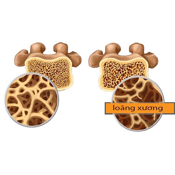 Giúp tăng chiều cao & phòng loãng xương Swanson Calcium with Vitamins D & K