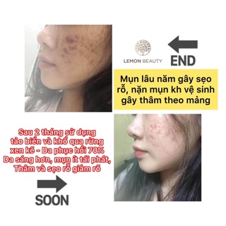 < MUA 1 TẶNG NHIỀU QUÀ > Lemonmask khổ qua rừng tặng quà hấp dẫn ( mẫu mã mới )