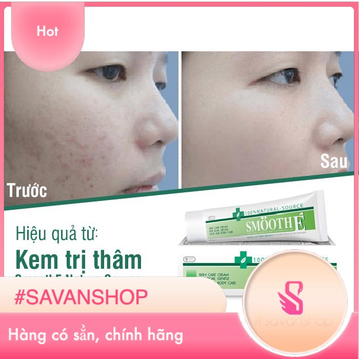 Kem Mờ Thâm & Dưỡng Da Smooth E Top#1 Thái Lan